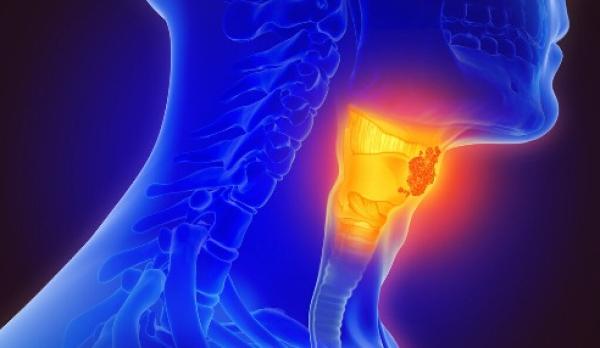 Baş Boyun Kanserlerini Tanıyın